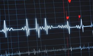 Qual é a importância de saber a frequência cardíaca máxima?