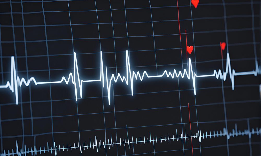 Qual é a importância de saber a frequência cardíaca máxima?