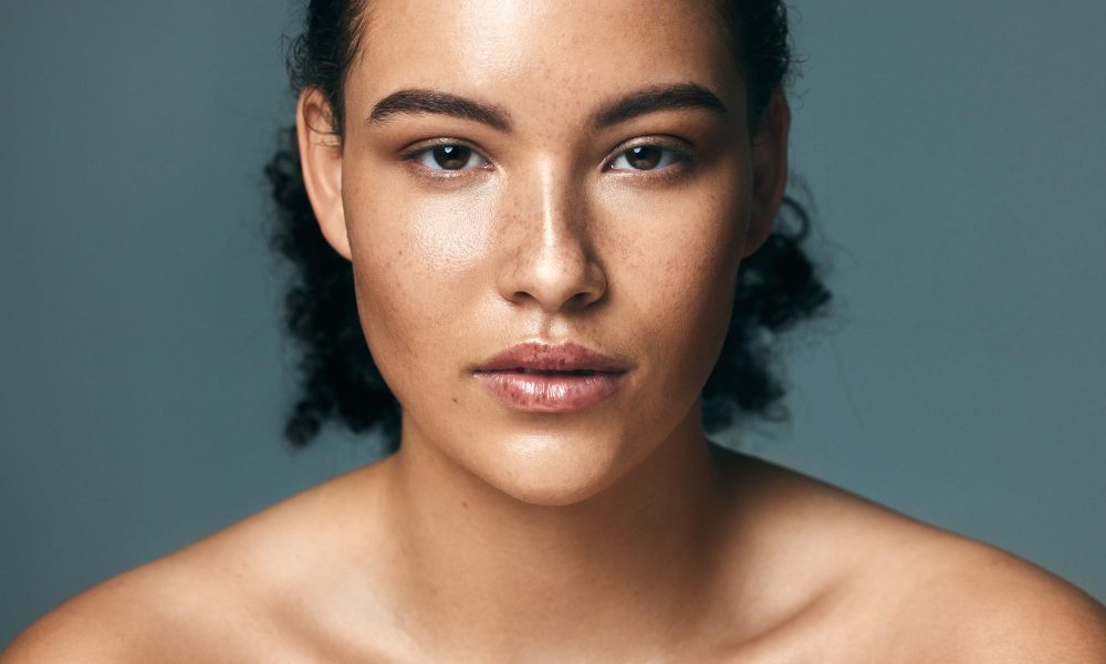 Melasma na mulher que corre: o que a ciência revela